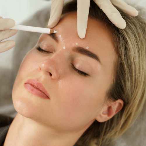 Dermal Fillers in Kilmarnock & Ayrshire